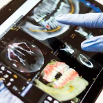 Une tablette présentant les résultats d'examens dentaires
