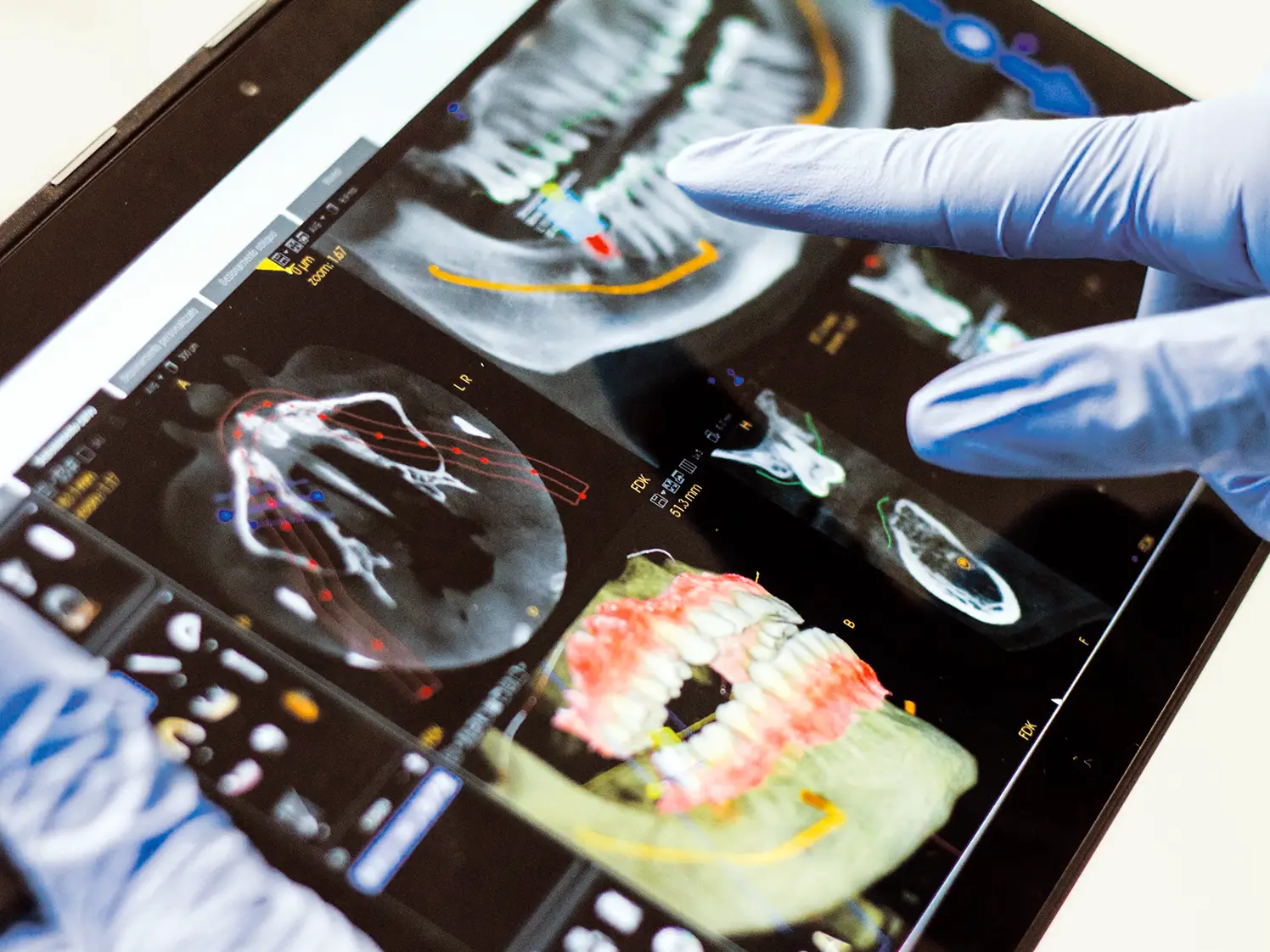 Une tablette présentant les résultats d'examens dentaires